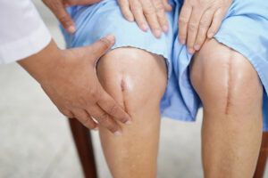 Knee Injuries