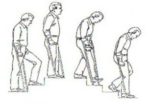 Stairs exercise