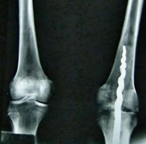 ancient Egyptian orthopaedics xray